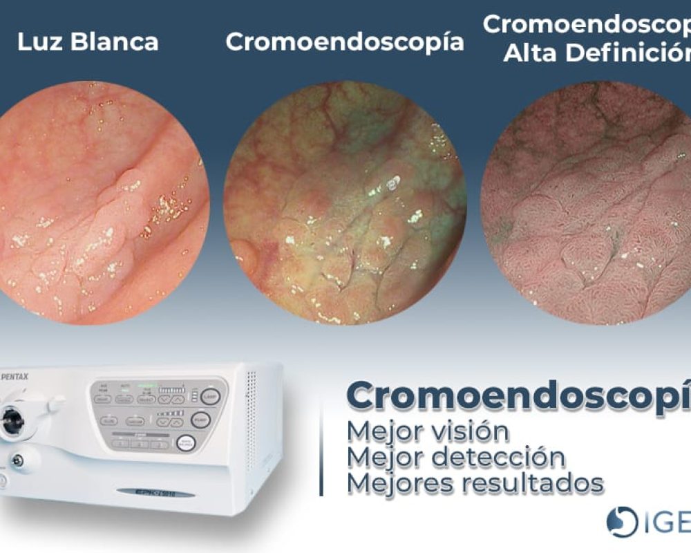 cromo